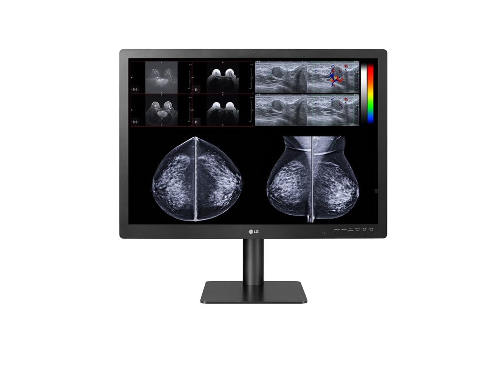 LG 31HN713D-B - 31-inch 12MP IPS Diagnostic Monitor for Mammography with Multi-resolution Modes