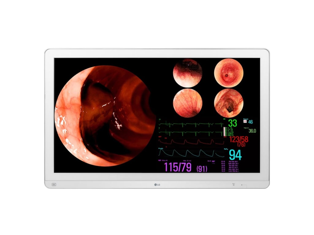 LG 32HL710S-W - 32” 4K LCD IPS Surgical Monitor, 4PBP Support, Dustproof, Water-Resistant
