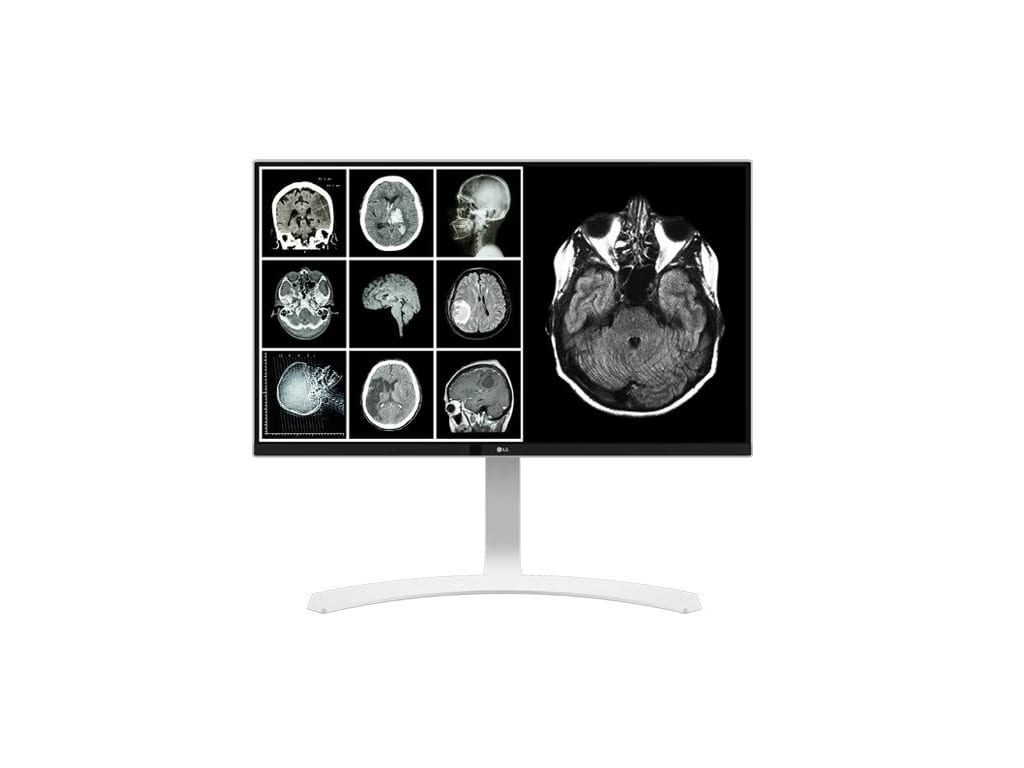 LG 27HJ712C-W - 27" Clinical Review Monitor with 8MP and sRGB over 99%