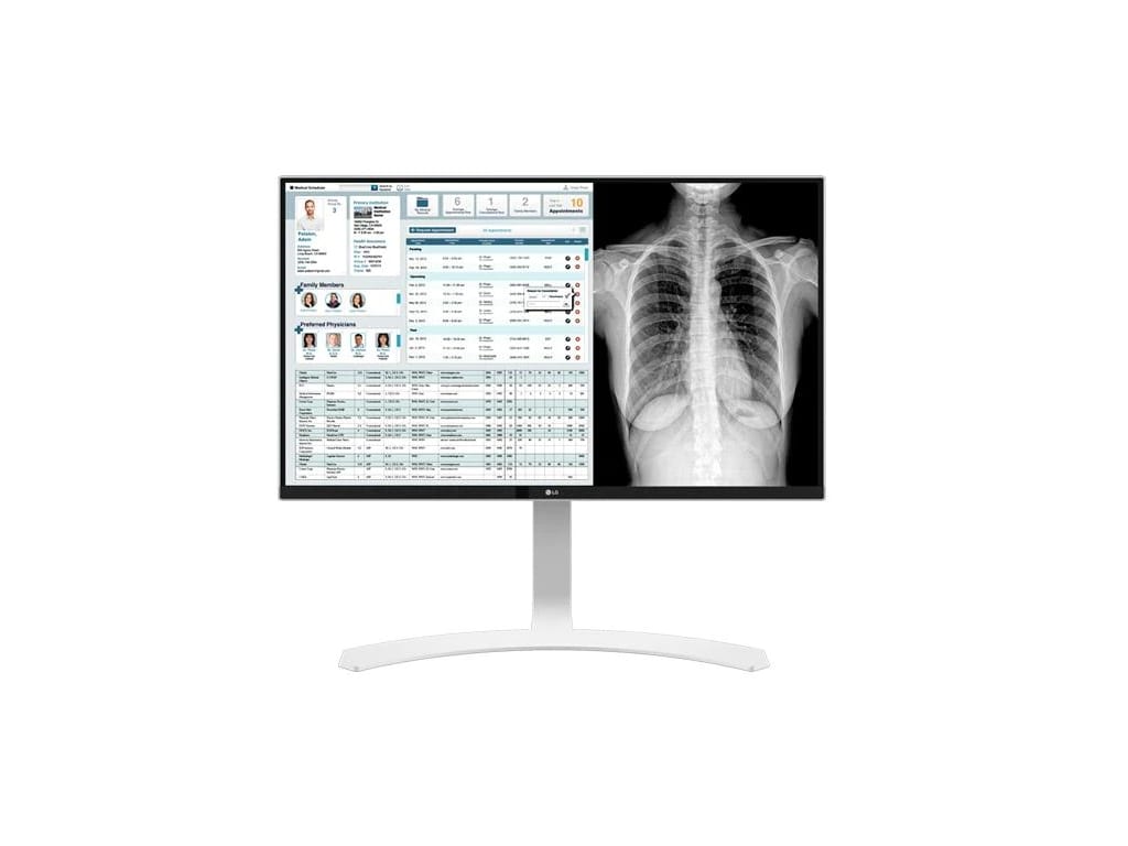 LG 27HJ712C-W - 27" Clinical Review Monitor with 8MP and sRGB over 99%