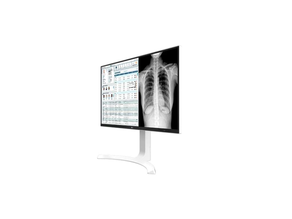 LG 27HJ712C-W - 27" Clinical Review Monitor with 8MP and sRGB over 99%