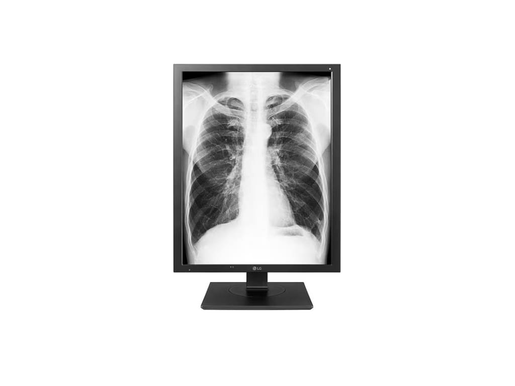 LG 21HK512D-B - 21.3'' 3MP Diagnostic Monitor with Auto Luminance Sensor