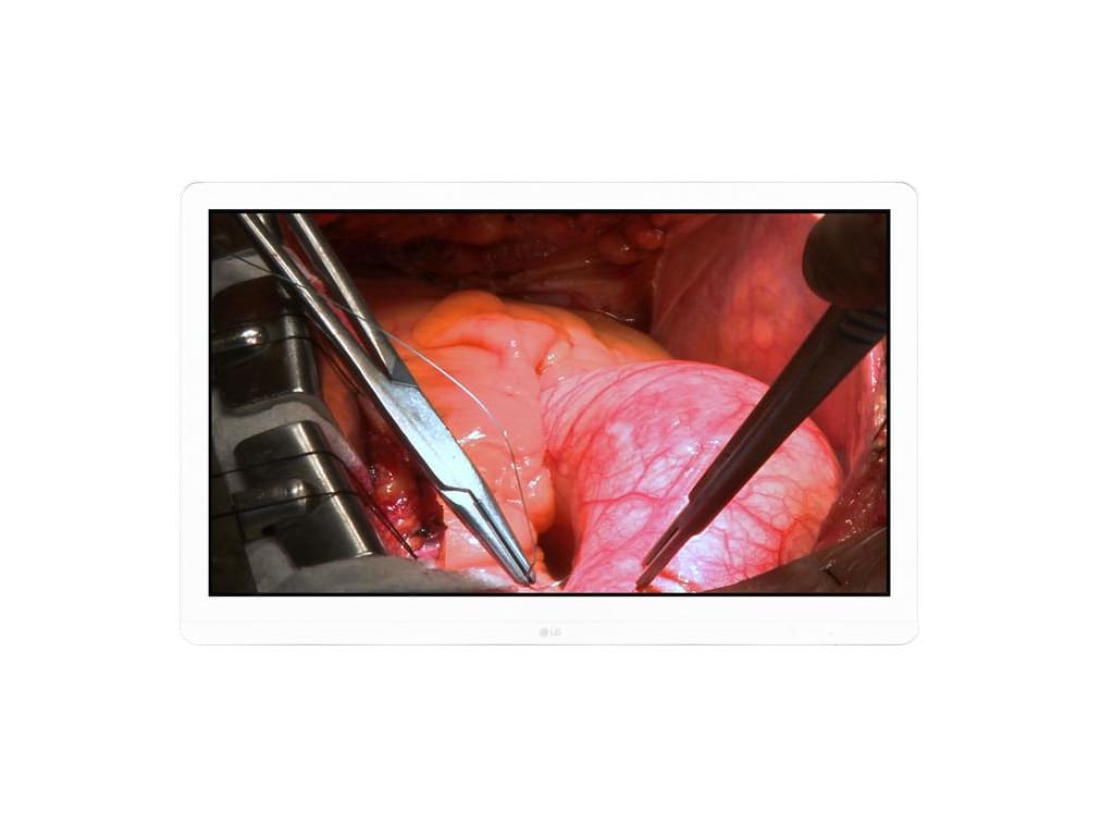 LG 27HJ713S-W - 27" 8MP Surgical Monitor (White) - FDA Class II
